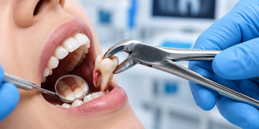 tooth-extor